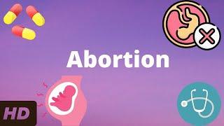 Abortion: Everything You Need To Know