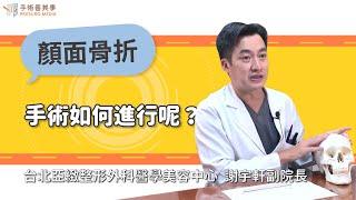 How is facial reconstruction surgery performed?｜Taipei Arts Plastic Clinic