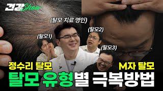 남성형 탈모 유형부터 개선 방법까지 완벽 정리!  (feat. 밸런스 게임)