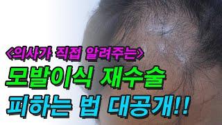 모발이식 재수술을 피하는 법 대공개!!