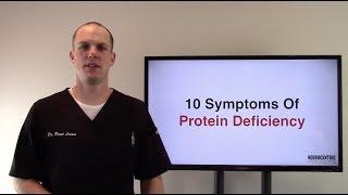 10 Protein Deficiency Symptoms