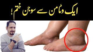 #1 Vitamin To Eliminate Swelling In Feet and Legs - Dr Irfan Azeem