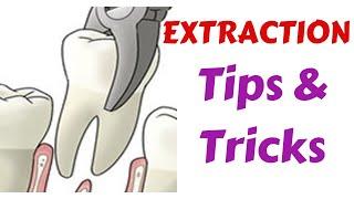 Exodontia Tips & Tricks - Diagnosis & Treatment Panning || Indication, Medical & Dental Evaluation