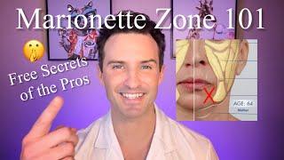 Marionette Zone Filler 101