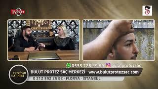 EKONOMİ SAHNESİ BULUT PROTEZ SAÇ MERKEZİ