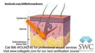 Wound Care 101