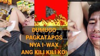 Dumugo pagkatapos nya i-wax ang kili kili ko!