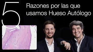  5 Razones por las que usamos INJERTO de HUESO Autólogo - [Técnica de KHOURY] - Implantes Dentales