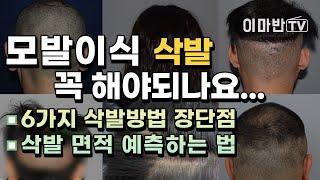 비절개 모발이식은 삭발이 필수인가요? 6가지 삭발 방법 별 장단점 정리 │삭발 범위 미리 예측해보기