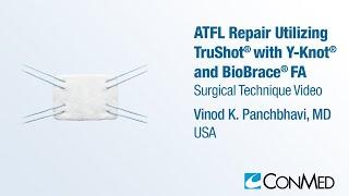 Dr. Vinod Panchbhavi - ATFL Repair Utilizing TruShot® with Y-Knot® and BioBrace® - CONMED Technique