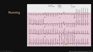 Technology Series/Medical-Stress Testing Pearls