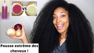 UTILISEZ LE JUS D'OIGNON POUR UNE POUSSE EXTRÊME DE VOS CHEVEUX ! Oignon Jaune VS Oignon Rouge