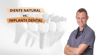 ¿Por qué es mejor conservar mi diente natural? Diente natural vs. Implante dental - Javier Ochagavia