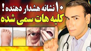 10 نشانه هشدار دهنده که کلیه هات سمی شدند (باید بدانید) | Signs That Your Kidneys Have Become Toxic