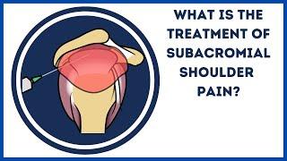 What is the treatment of subacromial shoulder pain