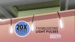 Pro Pulse Technology of the Remington iLIGHT Pro Plus