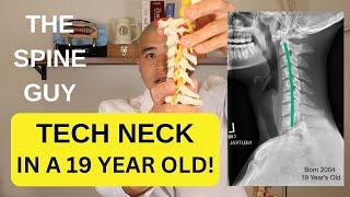 5 Exercises to maintain your cervical spine to prevent neck surgery!