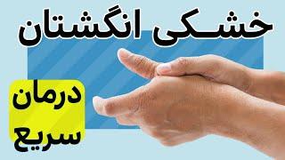 درمان خشکی انگشتان دست در منزل |STOP Hand, Knuckles, & Finger Pain/Stiffnessf