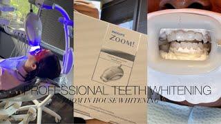 Zoom whitening Professional teeth whitening at the dentist / tutorial