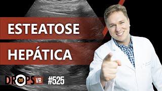 COMO AVALIAR ESTEATOSE HEPÁTICA NO ULTRASSOM  / VOCÊ RADIOLOGISTA