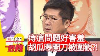 痔瘡問題讓人害羞？胡瓜自爆開刀被圍觀？！【醫師好辣】20200618 part1 EP965 賴昕隄 岑永康