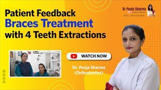 #SucessStory: Braces Treatment with 4 Teeth Extraction in Agra, India | Dr Pooja Sharma Dentist