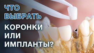 Коронки или имплант: что лучше выбрать? / Если зуб разрушен, удалять и ставить имплант или коронку?