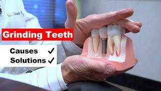 Grinding Teeth (Bruxism) - A Major Cause of Gum Recession