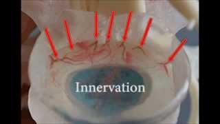 Disc Pain in the Spine | Dynamic Disc Designs Corp.