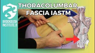 Thoracolumbar Fascia IASTM