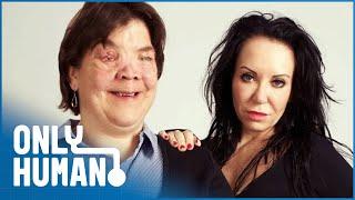 A Beauty Addict Meets A Woman With Facial Disfigurements | Only Human