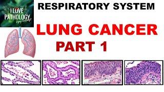 LUNG CANCER- Part 1- Epidemiology, Etiopathogenesis, Precursor lesions & Classification