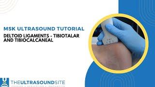 Musculoskeletal ultrasound evaluation of the ankle deltoid ligaments - tibiotalar + tibiocalcaneal.