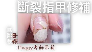 Broken nail repair｜Nail injury emergency treatment｜Correction type crystal fixed split nail