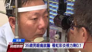 35歲男眼痛就醫　罹虹彩炎視力剩0 1 20170910 公視晚間新聞