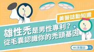 植髮｜地中海禿頭是男性專利？從毛囊基因認識你的禿頭原因【ME美醫誌】