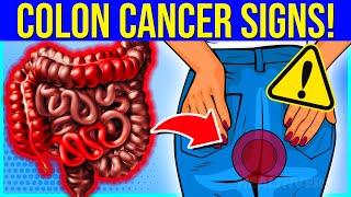 11 CRITICAL Signs Of Colon Cancer You Must Not Ignore