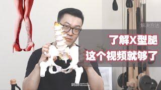 解构运动丨你的X型腿属于哪一种？如何解决？