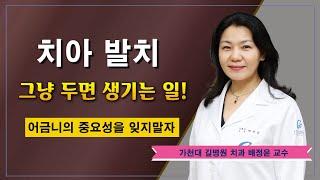 치아 발치 후 방치한다?  어금니 발치 후 관리 / 가천대 길병원 치과 배정윤 교수