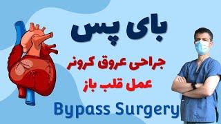 عمل جراحی قلب باز، بای پس عروق کرونر قلب به زبان ساده: Bypass Surgery