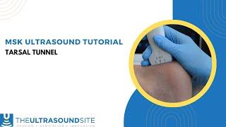 Musculoskeletal ultrasound of the tarsal tunnel including tibialis posterior and tibial nerve.