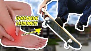 Lesiones y fracturas en Skateboard y sus cuidados | R2ARTUR