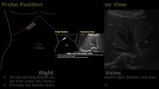 Right Liver Lobe & Hepatic Veins Probe Positioning | Ultrasound Transducer Placement USG #shorts