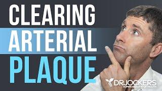 Clearing Arterial Plaque - Dr David Jockers