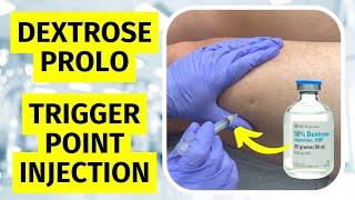 Prolotherapy Trigger Point Injection for Myofascial Pain Syndrome