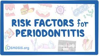 Risk Factors for Periodontitis