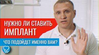 Нужно ли устанавливать зубной имплант? Мосты, съемные протезы, импланты | Стоматолог Доктор Коннов