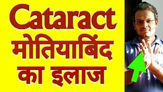 Acupressure Points For CATARACT - Remove Cataract Without SURGERY Pressing Points For 2 Minutes