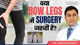 5 Surprising Facts About Bow Legs | Bow Legs के 5 Common Myths और Treatment | Dr. Vikram Mhaskar