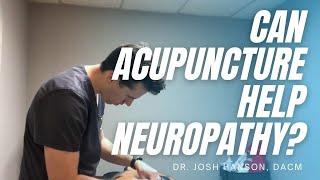 Can Acupuncture Help Neuropathy?